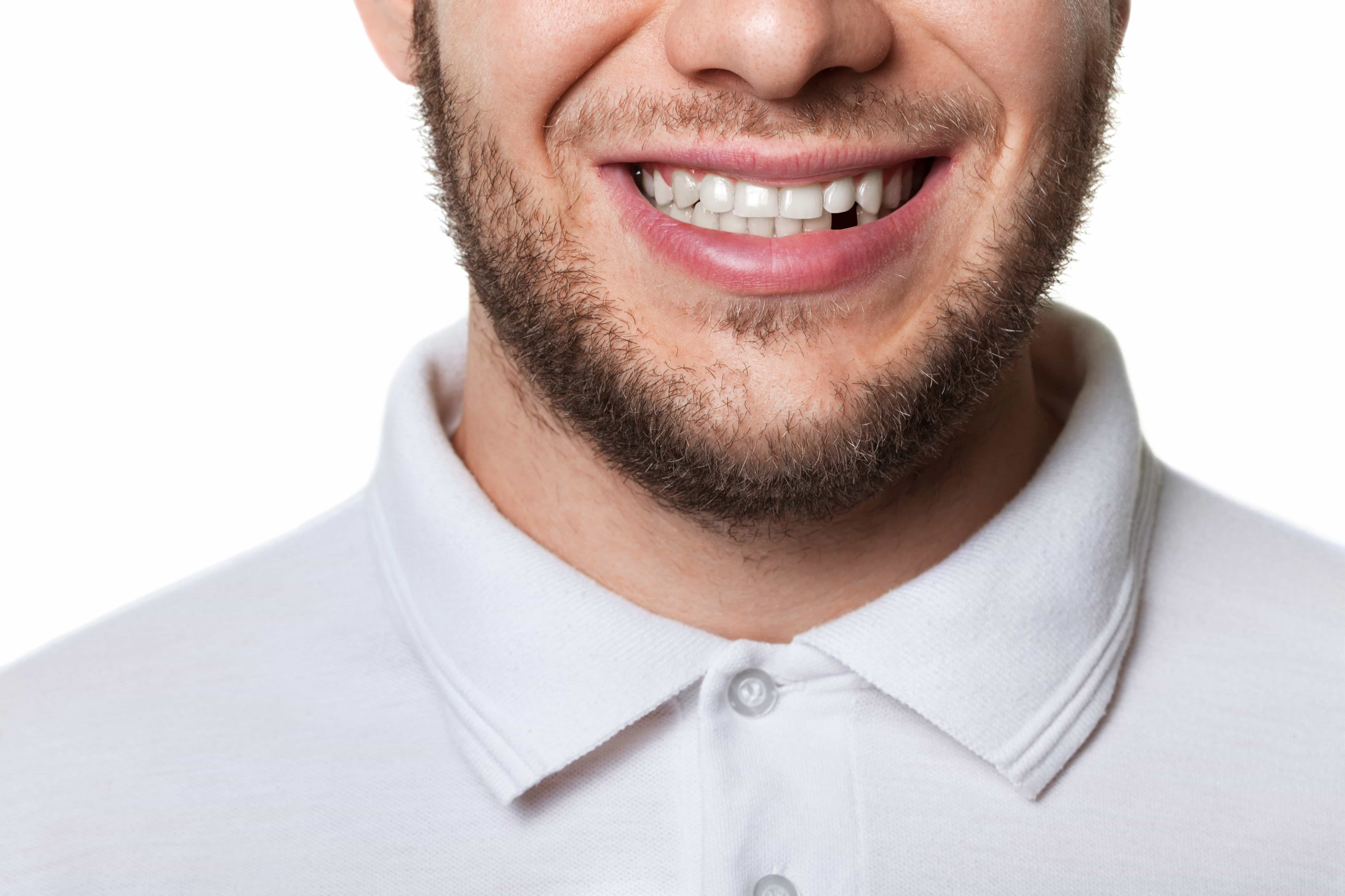 Reasons To Replace A Missing Tooth