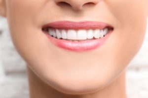 dental bonding and contouring