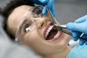 tooth extraction